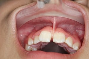 Align Dentistry Tongue Tie Treatment Chipping Norton